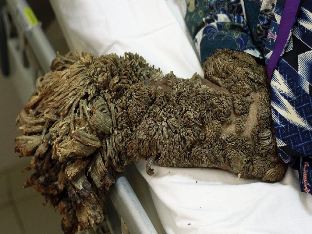 A close up of the Tree Man's right arm.